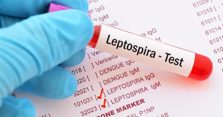 12 deaths due to Leptospirosis this year: Ministry of Health