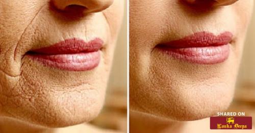 15 Science-Backed Remedies to Minimize Wrinkles and Look Younger