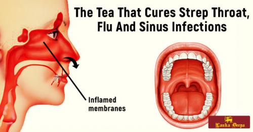 The Tea That Can Help Treat Strep Throat, Flu And Sinus Infections
